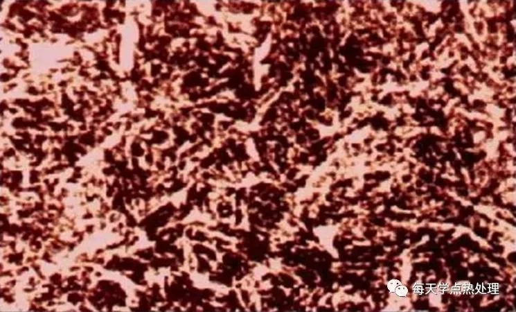 回火屈氏體金相圖.jpg 回火屈氏體金相圖.jpg